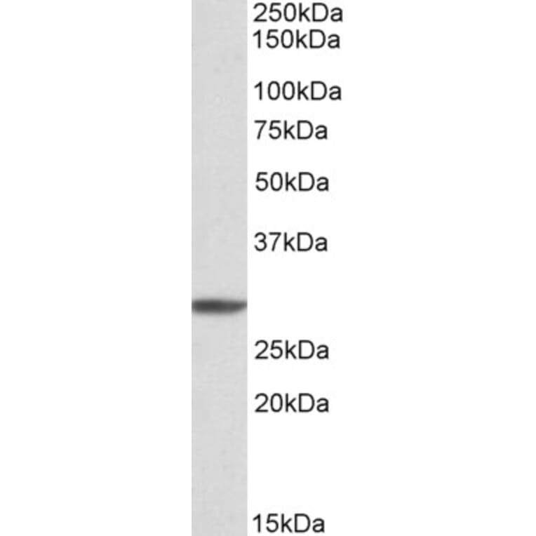 Western Blot - Anti-PSMA4 Antibody (A82893) - Antibodies.com