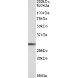 Western Blot - Anti-PSMA4 Antibody (A82893) - Antibodies.com