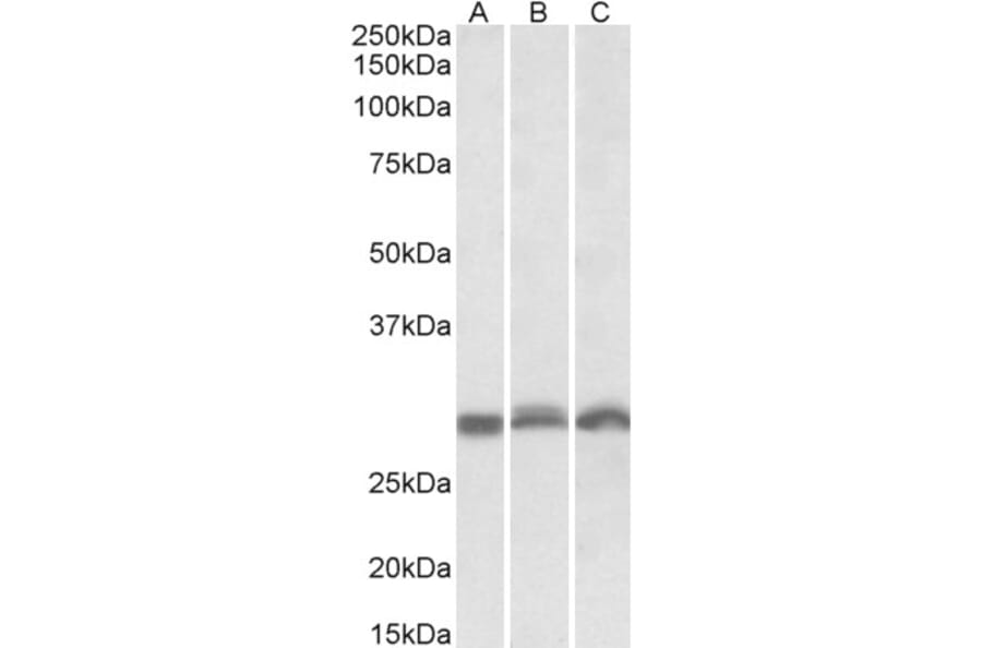 Western Blot - Anti-PSMA4 Antibody (A82893) - Antibodies.com