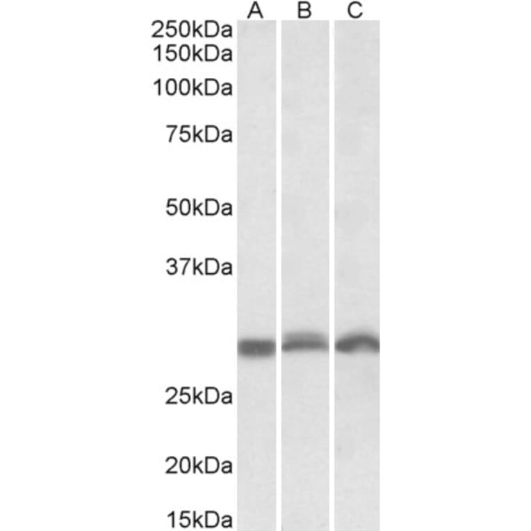 Western Blot - Anti-PSMA4 Antibody (A82893) - Antibodies.com