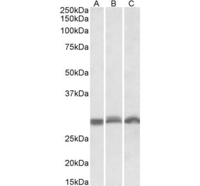 Western Blot - Anti-PSMA4 Antibody (A82893) - Antibodies.com
