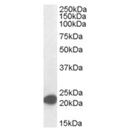 Western Blot - Anti-MAX Antibody (A82896) - Antibodies.com