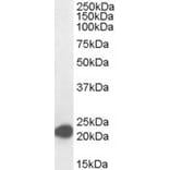 Western Blot - Anti-MAX Antibody (A82896) - Antibodies.com