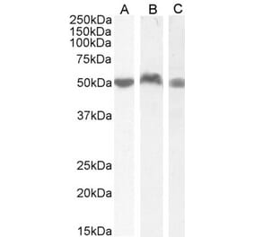 Western Blot - Anti-LSP1 Antibody (A82898) - Antibodies.com