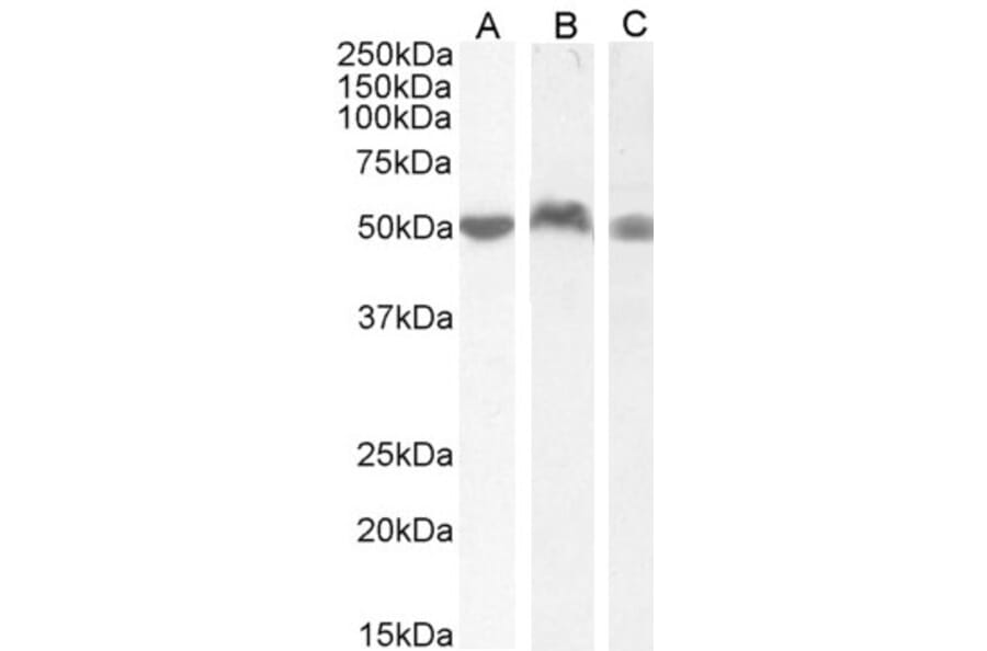 Western Blot - Anti-LSP1 Antibody (A82898) - Antibodies.com