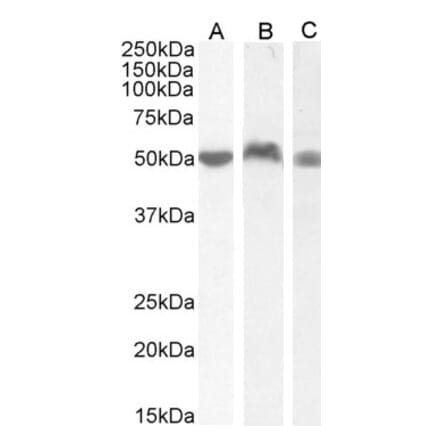 Western Blot - Anti-LSP1 Antibody (A82898) - Antibodies.com