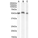 Western Blot - Anti-LSP1 Antibody (A82898) - Antibodies.com