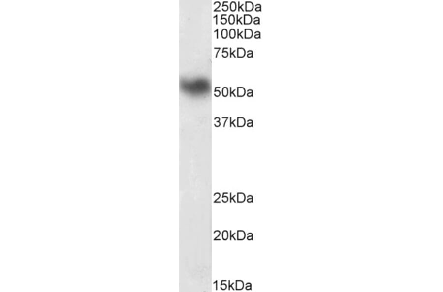 Western Blot - Anti-LSP1 Antibody (A82898) - Antibodies.com