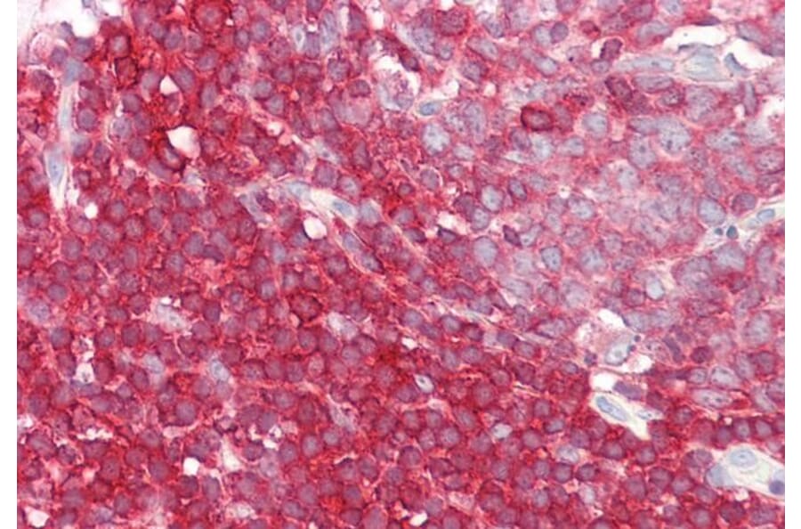 Immunohistochemistry - Anti-LSP1 Antibody (A82898) - Antibodies.com
