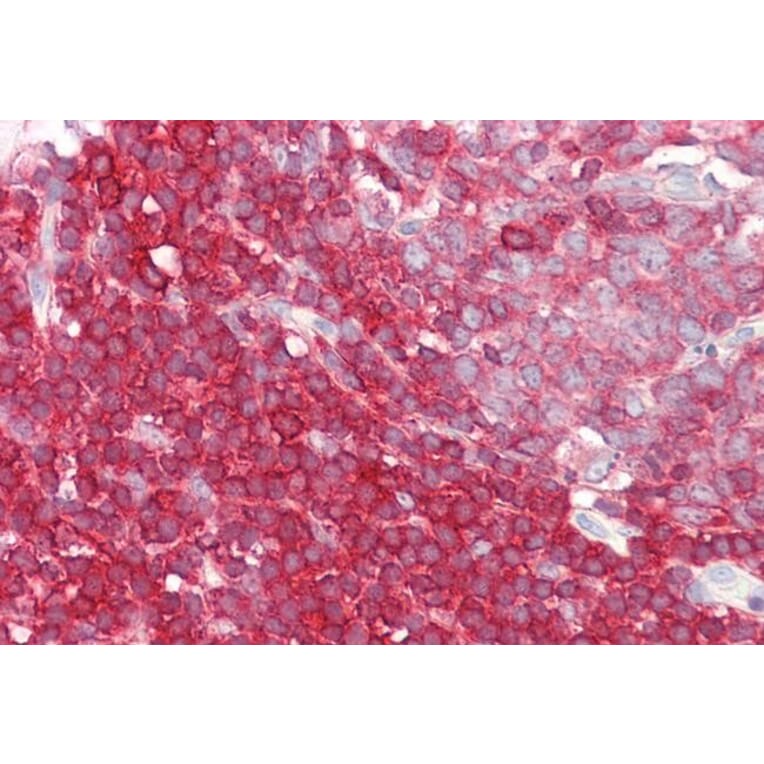 Immunohistochemistry - Anti-LSP1 Antibody (A82898) - Antibodies.com