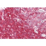 Immunohistochemistry - Anti-LSP1 Antibody (A82898) - Antibodies.com