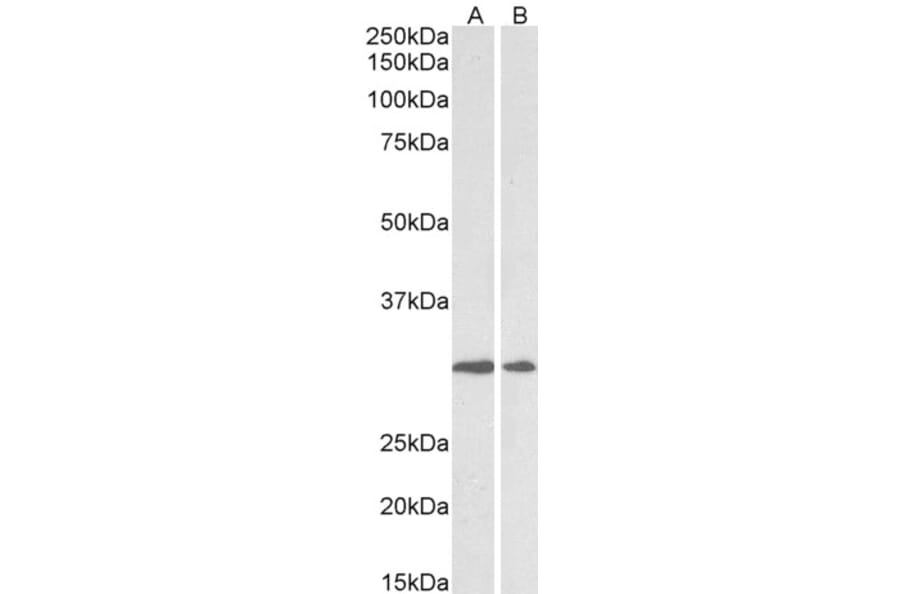 Western Blot - Anti-LOX Antibody (A82899) - Antibodies.com