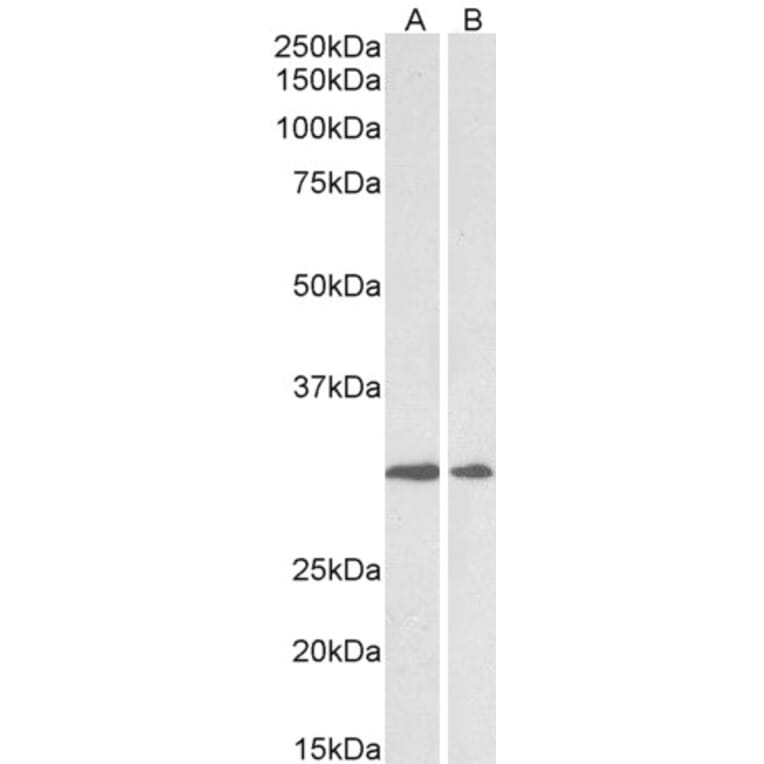 Western Blot - Anti-LOX Antibody (A82899) - Antibodies.com