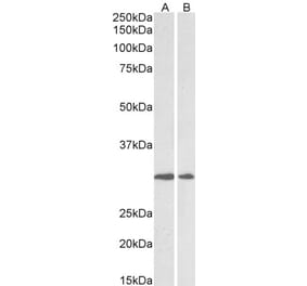 Western Blot - Anti-LOX Antibody (A82899) - Antibodies.com