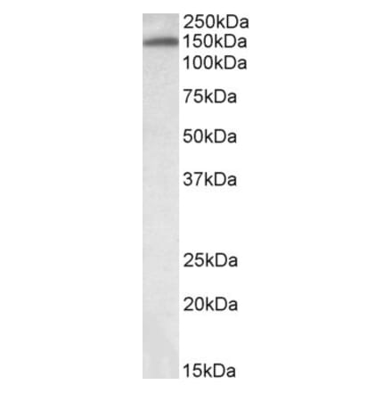 Western Blot - Anti-ITIH4 Antibody (A82900) - Antibodies.com