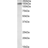 Western Blot - Anti-ITIH4 Antibody (A82900) - Antibodies.com