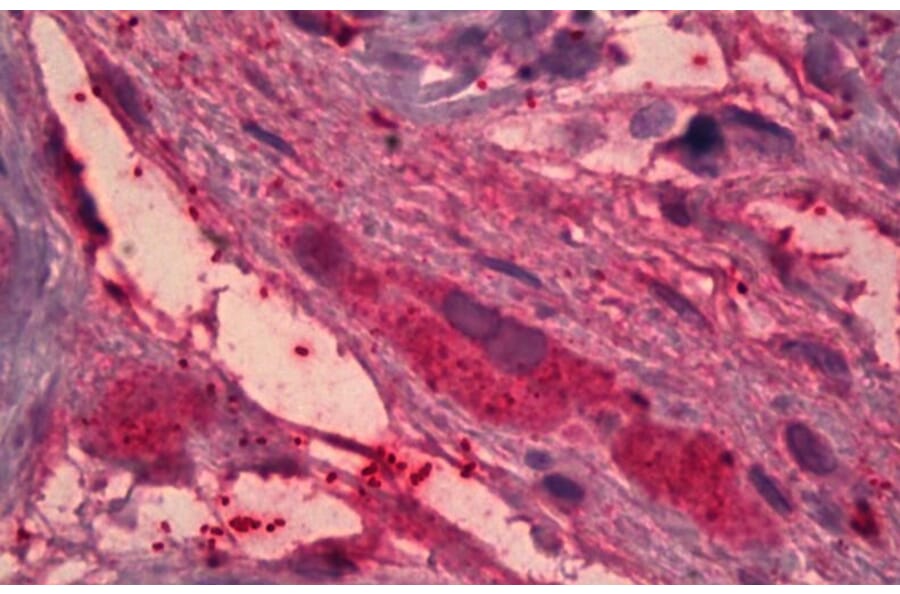 Immunohistochemistry - Anti-ITIH4 Antibody (A82900) - Antibodies.com