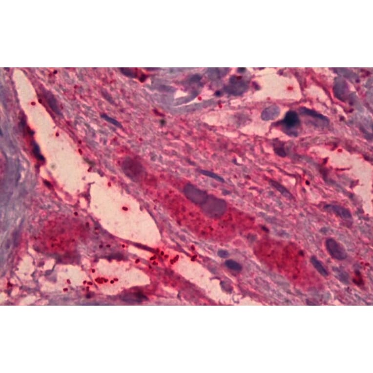 Immunohistochemistry - Anti-ITIH4 Antibody (A82900) - Antibodies.com