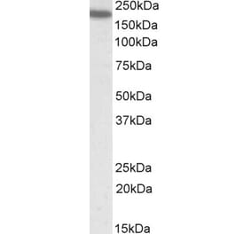 Western Blot - Anti-CD11A Antibody (A82902) - Antibodies.com