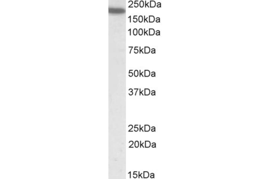 Western Blot - Anti-CD11A Antibody (A82902) - Antibodies.com