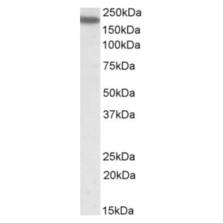 Western Blot - Anti-CD11A Antibody (A82902) - Antibodies.com