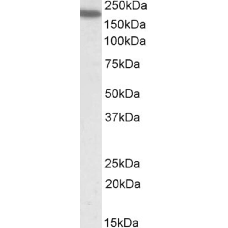 Western Blot - Anti-CD11A Antibody (A82902) - Antibodies.com
