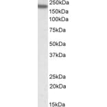 Western Blot - Anti-CD11A Antibody (A82902) - Antibodies.com