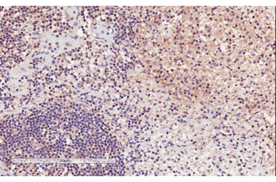 Immunohistochemistry - Anti-CD11A Antibody (A82902) - Antibodies.com