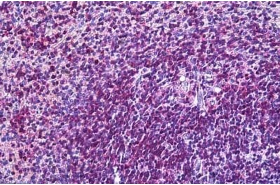 Immunohistochemistry - Anti-CD11A Antibody (A82902) - Antibodies.com