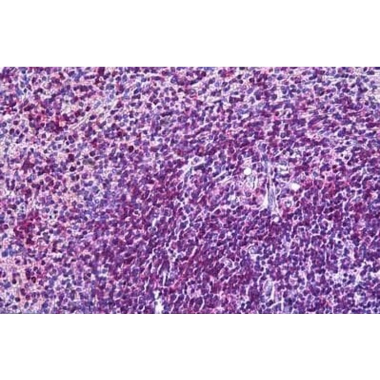 Immunohistochemistry - Anti-CD11A Antibody (A82902) - Antibodies.com
