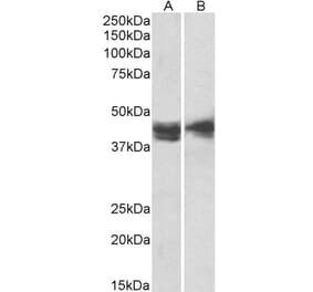 Western Blot - Anti-IL3RA/CD123 Antibody (A82903) - Antibodies.com