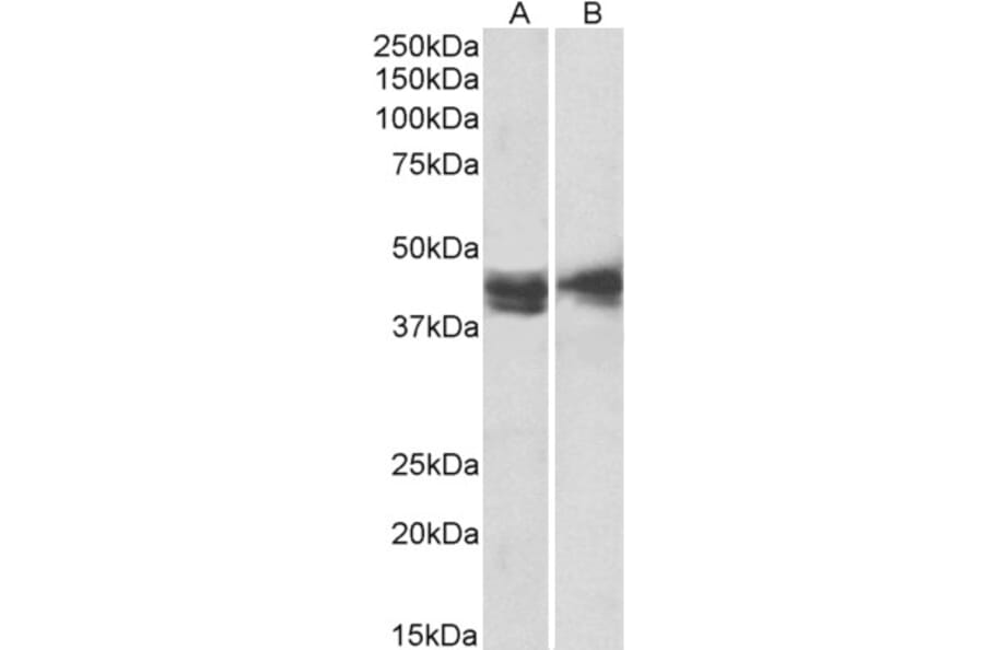 Western Blot - Anti-IL3RA/CD123 Antibody (A82903) - Antibodies.com