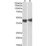 Western Blot - Anti-IL3RA/CD123 Antibody (A82903) - Antibodies.com