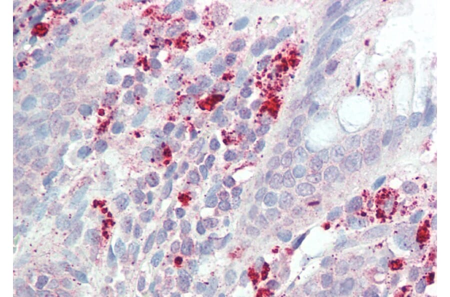 Immunohistochemistry - Anti-IL3RA/CD123 Antibody (A82903) - Antibodies.com