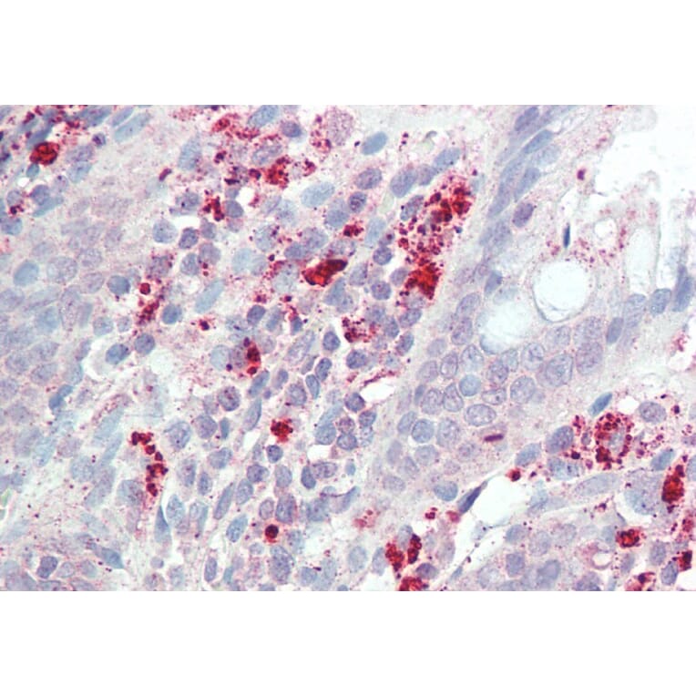 Immunohistochemistry - Anti-IL3RA/CD123 Antibody (A82903) - Antibodies.com