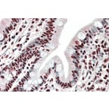 Immunohistochemistry - Anti-hnRNP A2B1 Antibody (A82904) - Antibodies.com
