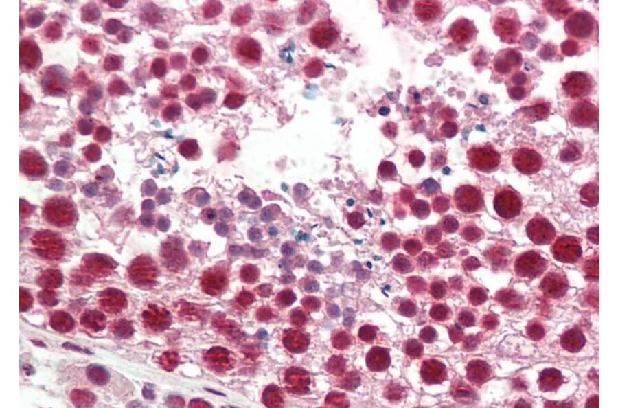 Immunohistochemistry - Anti-hnRNP A2B1 Antibody (A82904) - Antibodies.com