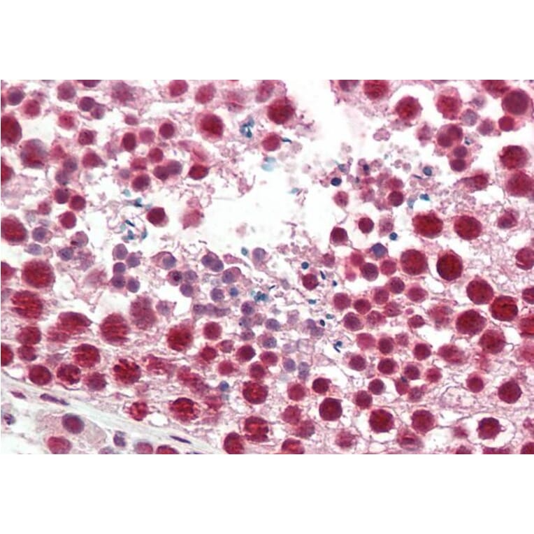 Immunohistochemistry - Anti-hnRNP A2B1 Antibody (A82904) - Antibodies.com