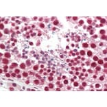 Immunohistochemistry - Anti-hnRNP A2B1 Antibody (A82904) - Antibodies.com