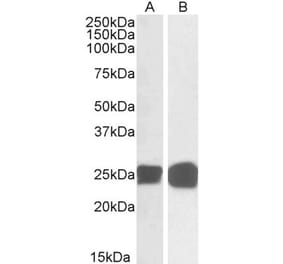 Western Blot - Anti-GRB2 Antibody (A82905) - Antibodies.com