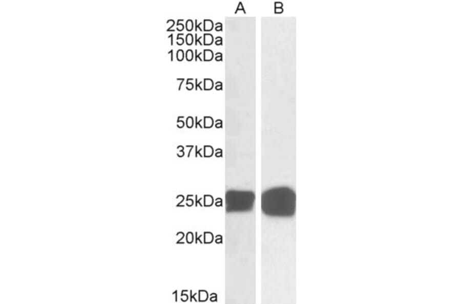 Western Blot - Anti-GRB2 Antibody (A82905) - Antibodies.com