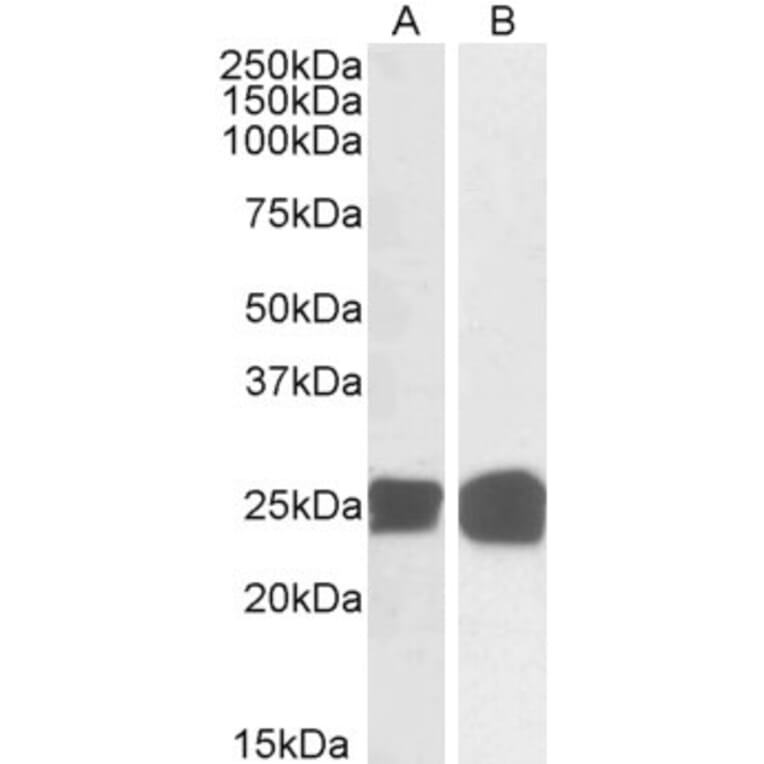 Western Blot - Anti-GRB2 Antibody (A82905) - Antibodies.com