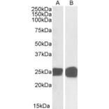 Western Blot - Anti-GRB2 Antibody (A82905) - Antibodies.com