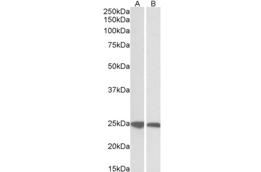 Western Blot - Anti-GRB2 Antibody (A82905) - Antibodies.com