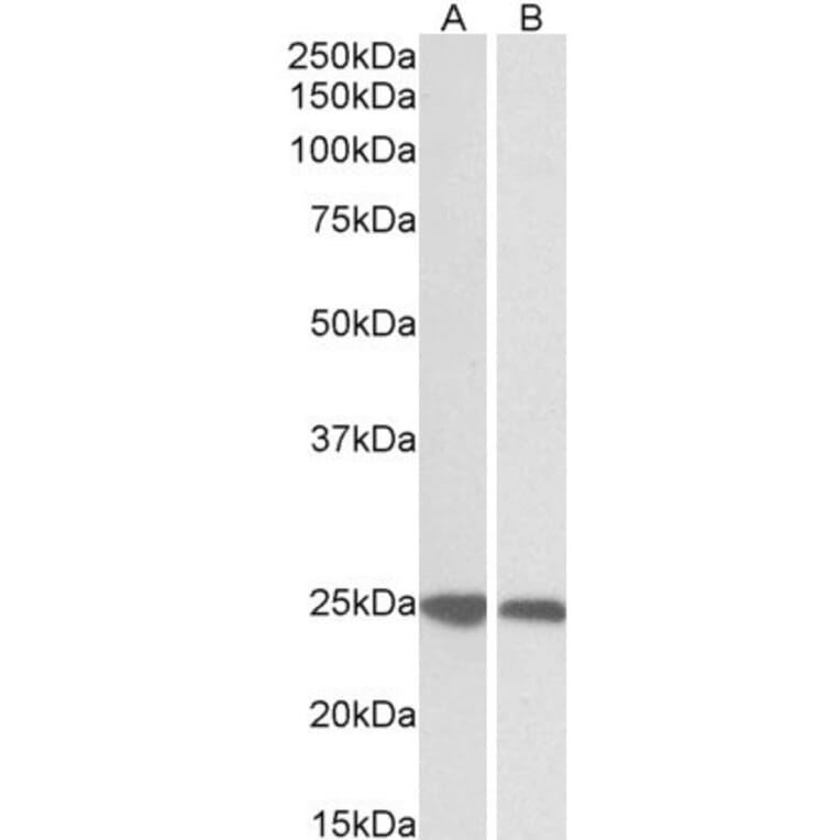 Western Blot - Anti-GRB2 Antibody (A82905) - Antibodies.com