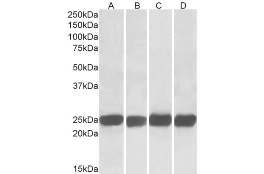 Western Blot - Anti-GRB2 Antibody (A82905) - Antibodies.com