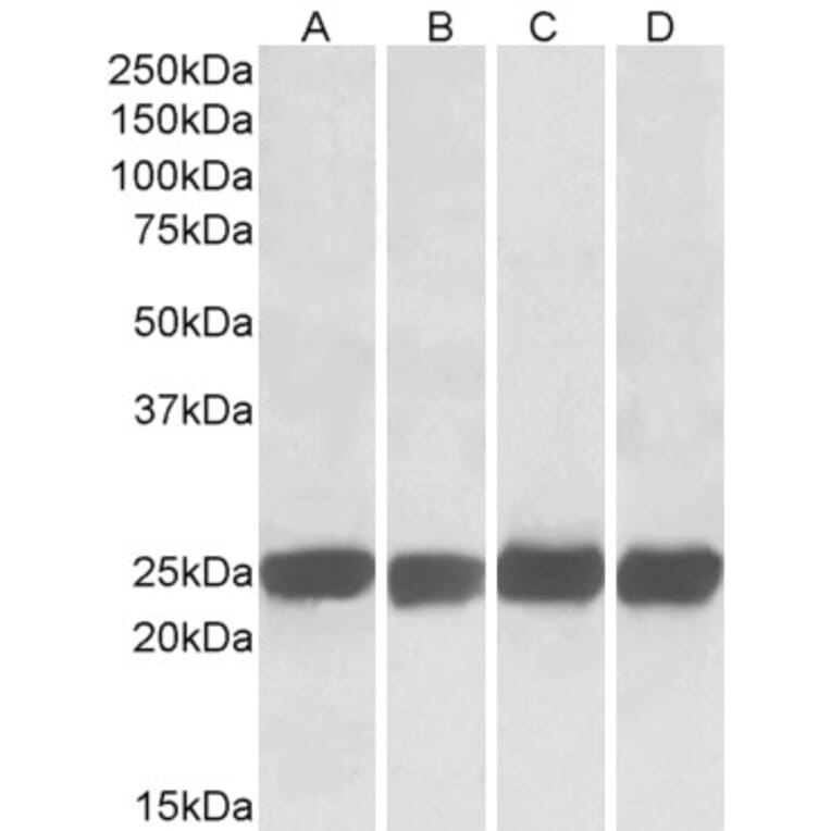 Western Blot - Anti-GRB2 Antibody (A82905) - Antibodies.com