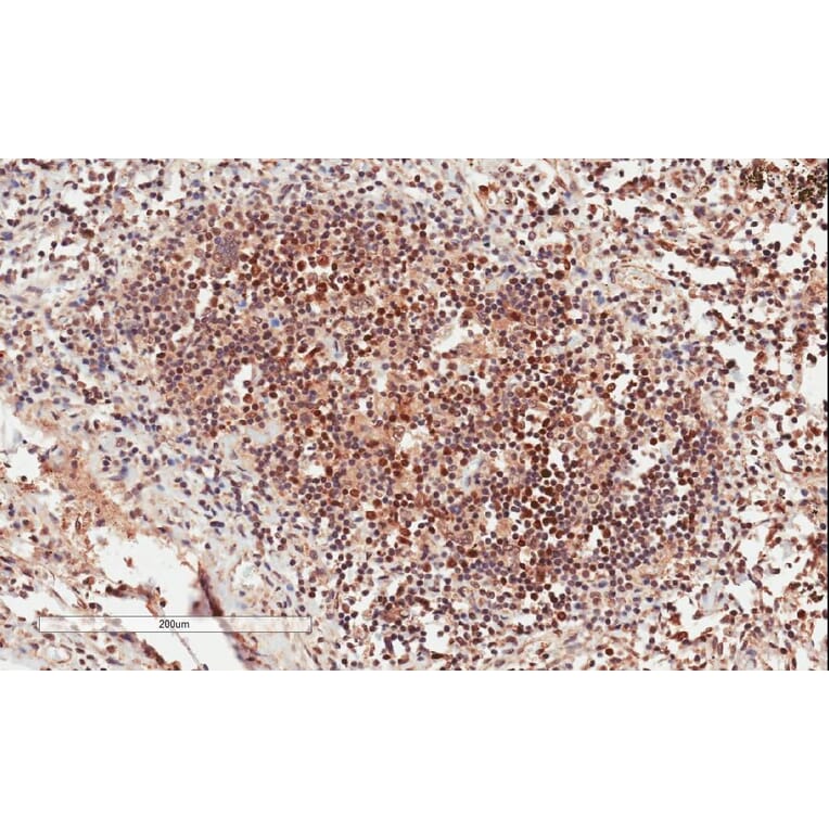 Immunohistochemistry - Anti-GRB2 Antibody (A82905) - Antibodies.com