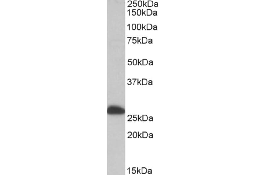 Western Blot - Anti-ETFB Antibody (A82910) - Antibodies.com