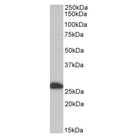 Western Blot - Anti-ETFB Antibody (A82910) - Antibodies.com